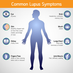  Lupus eritematos sistemic – simptome, tratament