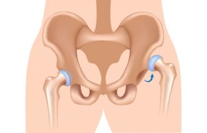 artrita blocului articulației umărului recenziile tratamentului cu artroza păpădie