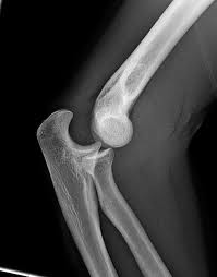 durere severă a articulației genunchiului și a mâinii