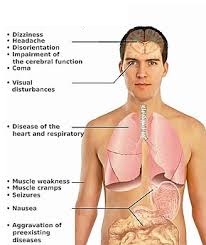 simptome intoxicatie monoxid de carbon
