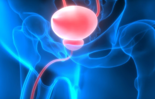perioade de exacerbare a prostatitei cronice prostate cancer treatment guidelines 2020