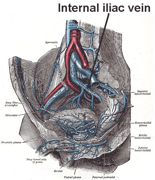  Arterele pelvisului - notiuni de anatomie