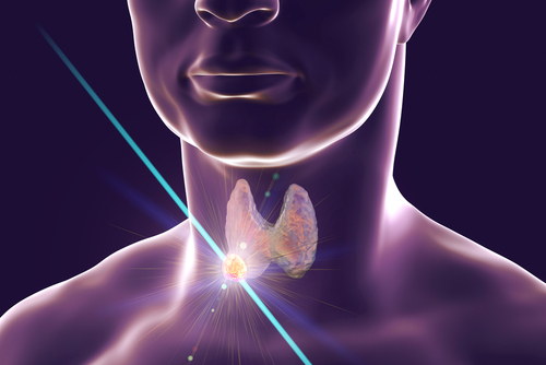  Nodulii tiroidieni-diagnostic si conduita