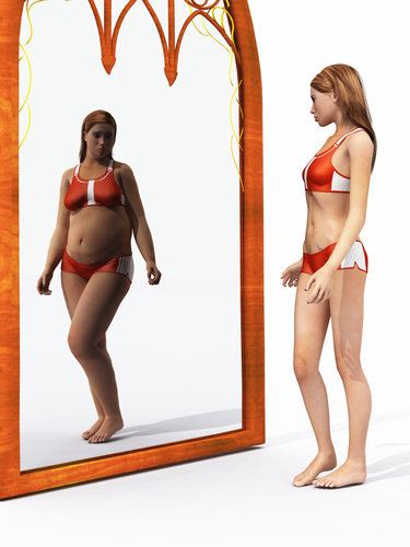 Anorexia nervoasă-cauze, simptome, tratament – eventisimo.ro