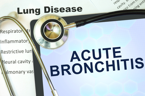  Bronșita acută – cauze, simptome și tratament