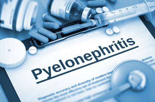  Pielonefrita acută –  simptome, diagnostic, tratament