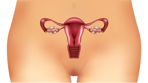  Sindrom de ovare polichistice – simptome, tratament