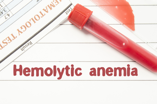 anemie hemolitica
