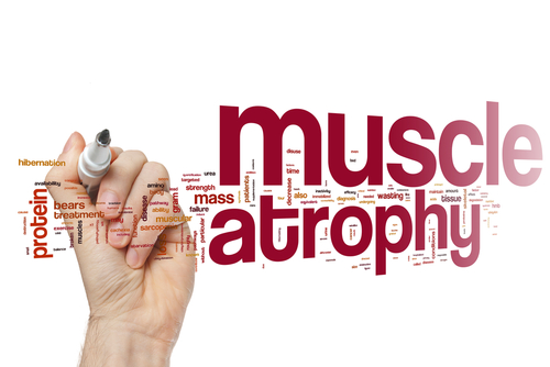  Atrofia musculară spinală (AMS) – TIPUL 1
