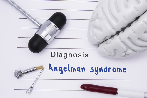  Sindromul Angelman – maladie genetică