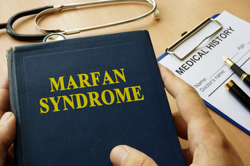  Sindromul Marfan – anomalie genetică