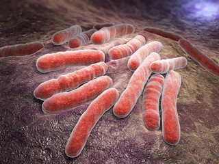  Mycobacterium tuberculosis (Bacilul Koch)