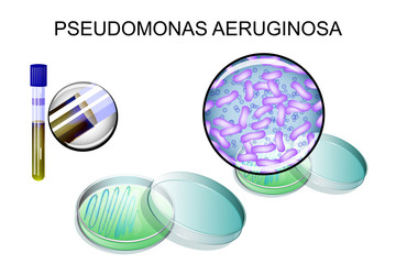  Pseudomonas Aeruginosa (Bacilul Pioceanic )