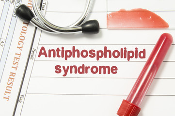  Sindromul antifosfolipidic – cauză a avortului spontan