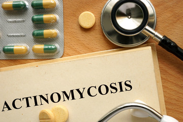  Actinomicoza- cauze, simptome, tratament