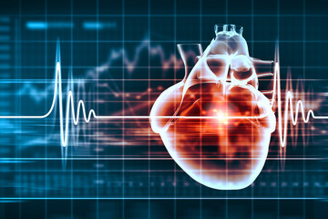  Șocul cardiogen – cauze și tratament