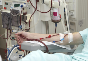 Pierderea în greutate la pacienții cu hemodializă după internare este legată de durata șederii și