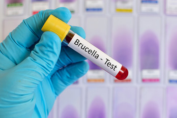  Bruceloza – boală infecțioasă