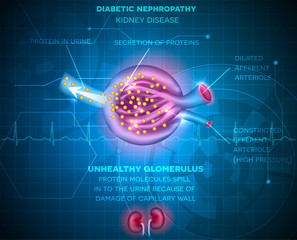  Nefropatia diabetică: diagnostic și tratament