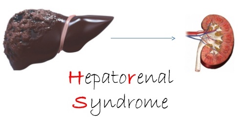  Sindromul hepato-renal: simptome, diagnostic, tratament
