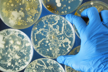  Infecții fungice – generalități