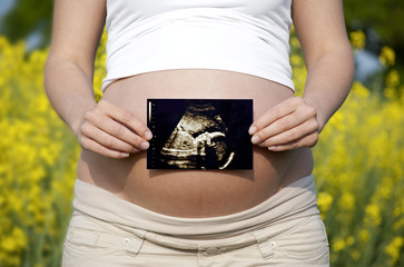 Ecografia fetală în timpul sarcinii