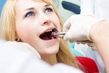  Extracția dentară: indicații, contraindicații, complicații