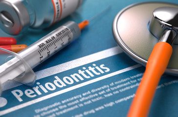  Parodontita – cauze, simptome, tratament