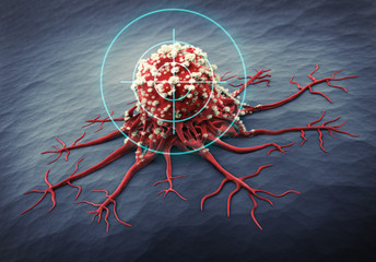 CancerSEEK: noua metodă de detectare a cancerului