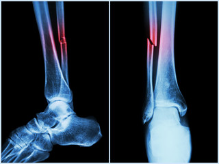 Cauzele frecvente ale durerii la nivelul picioarelor | Panadol