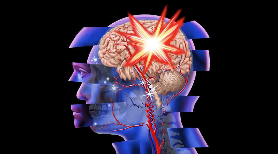 Traumatismele cranio-cerebrale: ce sunt, cum le tratăm – NewsMed.ro