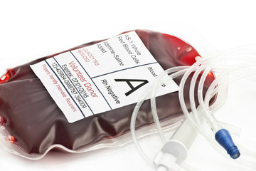  Transfuzia de sânge