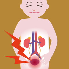 durere deasupra vezicii urinare care este remediul eficient pentru adenom de prostată