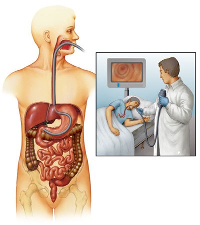  Rolul endoscopiei în hemoragia digestiva superioara