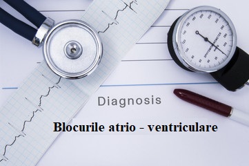  Blocurile atrio – ventriculare – cauze, simptome, tratament