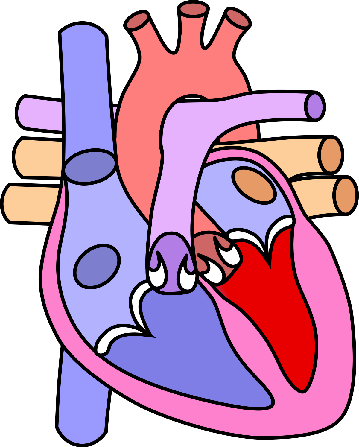  Canalul atrio-ventricular comun – malformație congenitală cardiacă