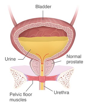 vezica urinara pozitionare