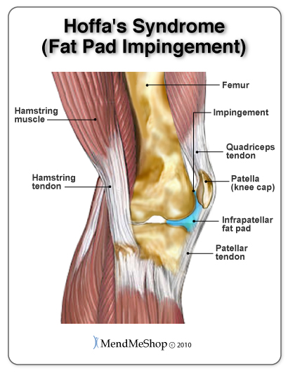 tratamentul articular al țesutului adipos articular tratamentul artrozei cu genunchiul argilos