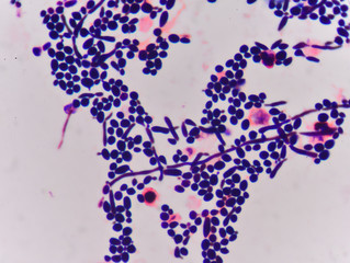 Staphylococcus Epidermidis Stafilococ Coagulazo Negativ Newsmed Ro
